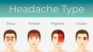 Migraine là một điều kiện lâm sàng gây đau đầu nặng và đau đớn, thường xuất hiện ở một bên đầu